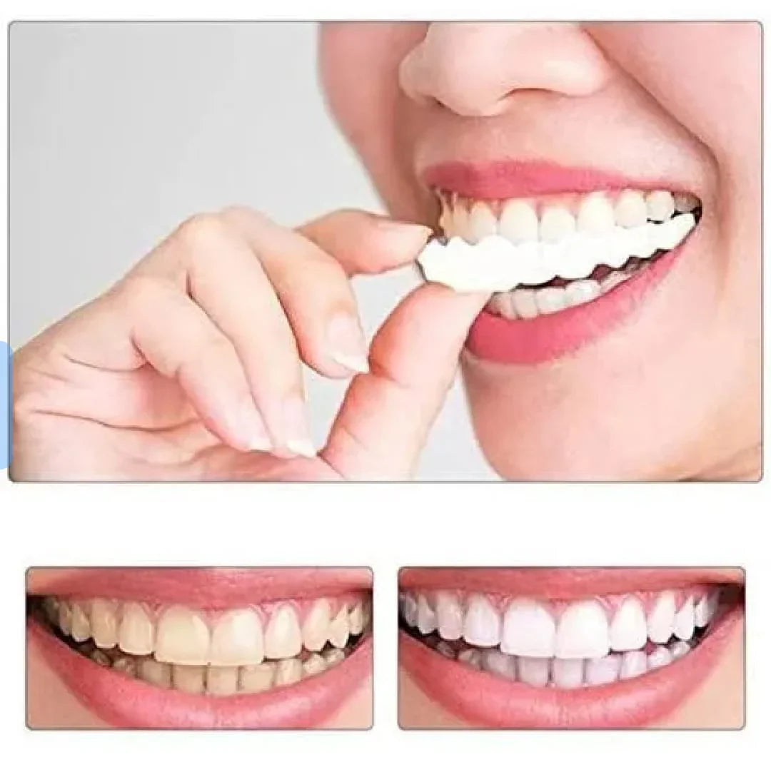 Instant Teeth Whitening Cover – Natural Veneer Tooth Cap for Perfect Smile | Reusable Fake Teeth