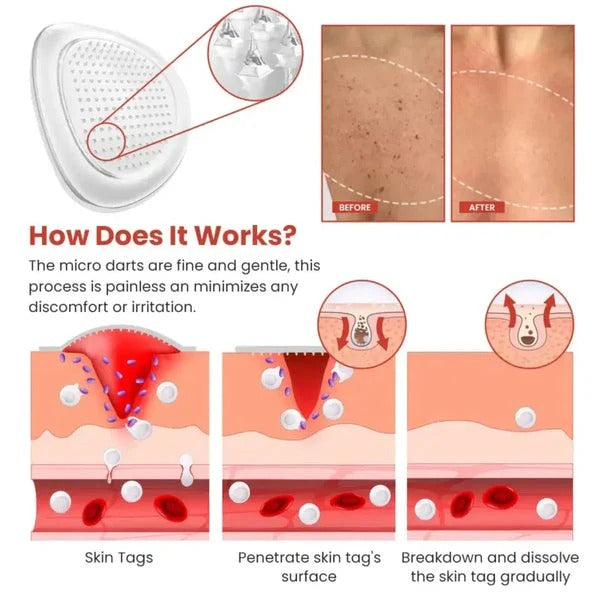DERMA SMOOTH TAG REMOVER