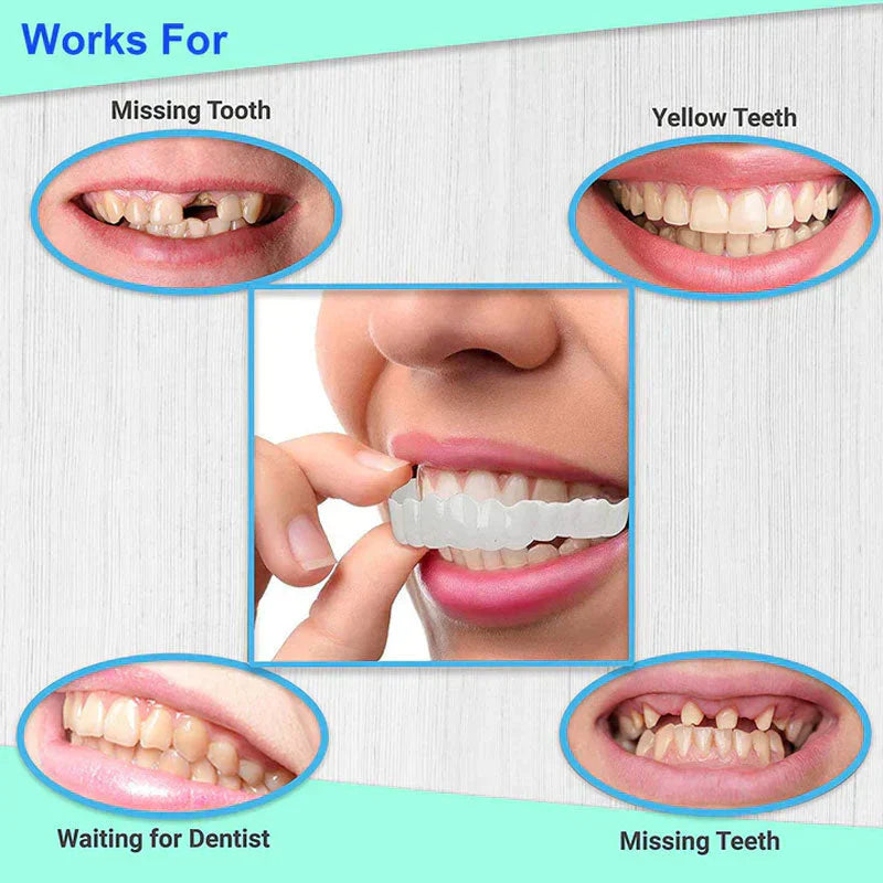 Snap on Smile