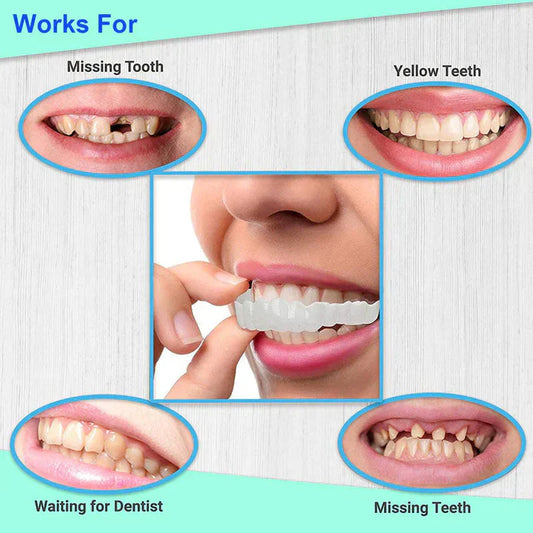 Snap on Smile